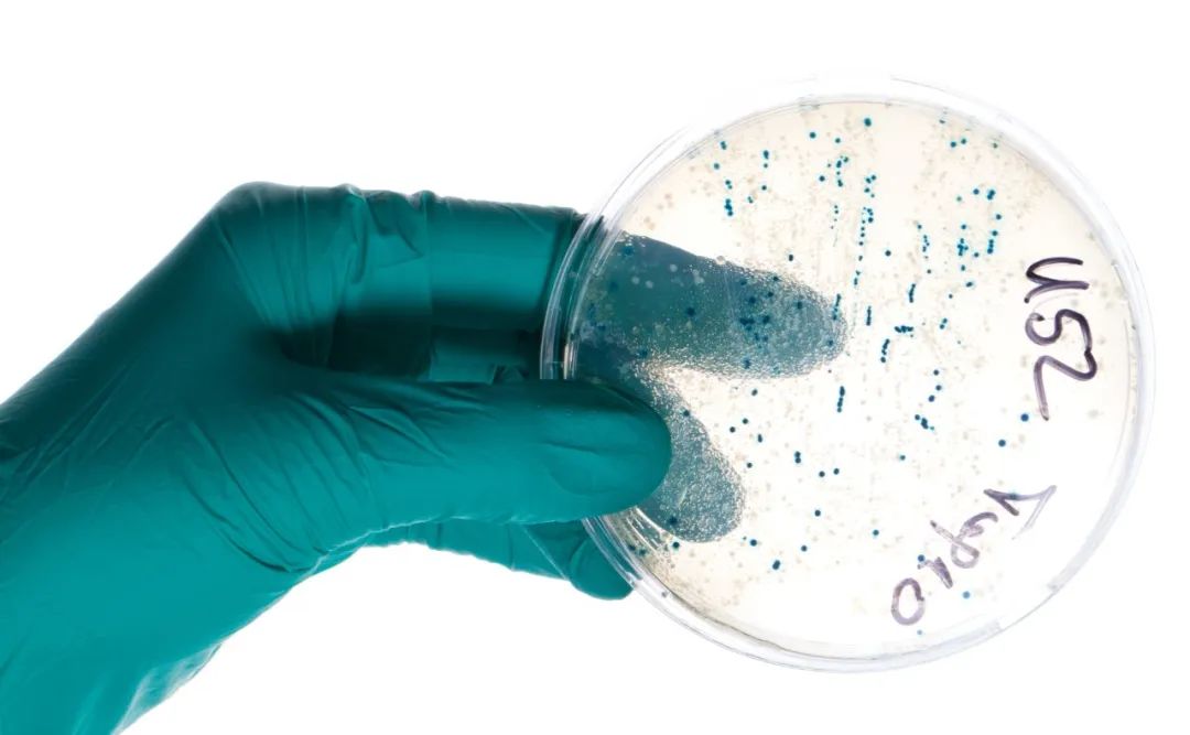 GB 4789.2-2022《食品安全國家標(biāo)準(zhǔn) 食品微生物學(xué)檢驗(yàn) 菌落總數(shù)測定》變化解析