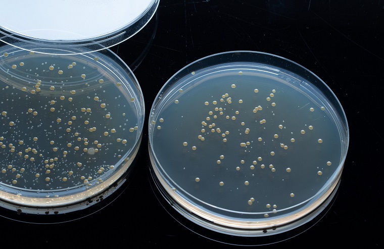 如何提高自動菌落分析儀的準(zhǔn)確性和可靠性？